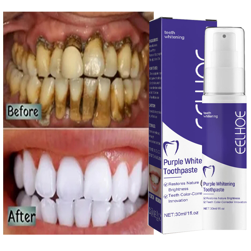 Teeth Whitening Korea - 1 قطعة تنظيف الأسنان تبييض معجون