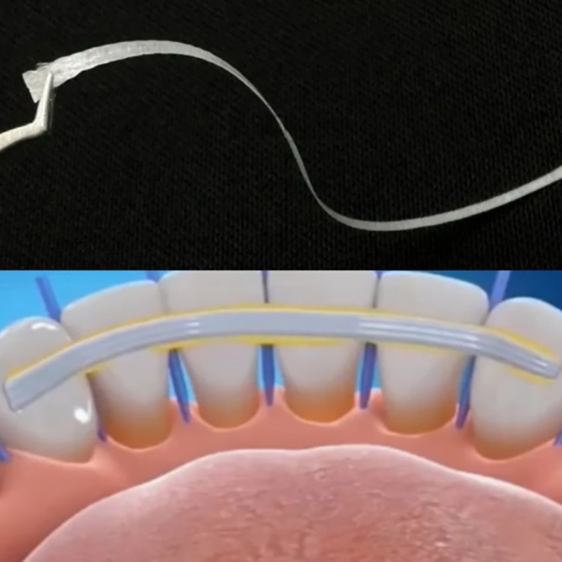 1/5 قطع شرائط تثبيت الأسنان ال - مراجعة Teeth Whitening Strips Crest وسعره