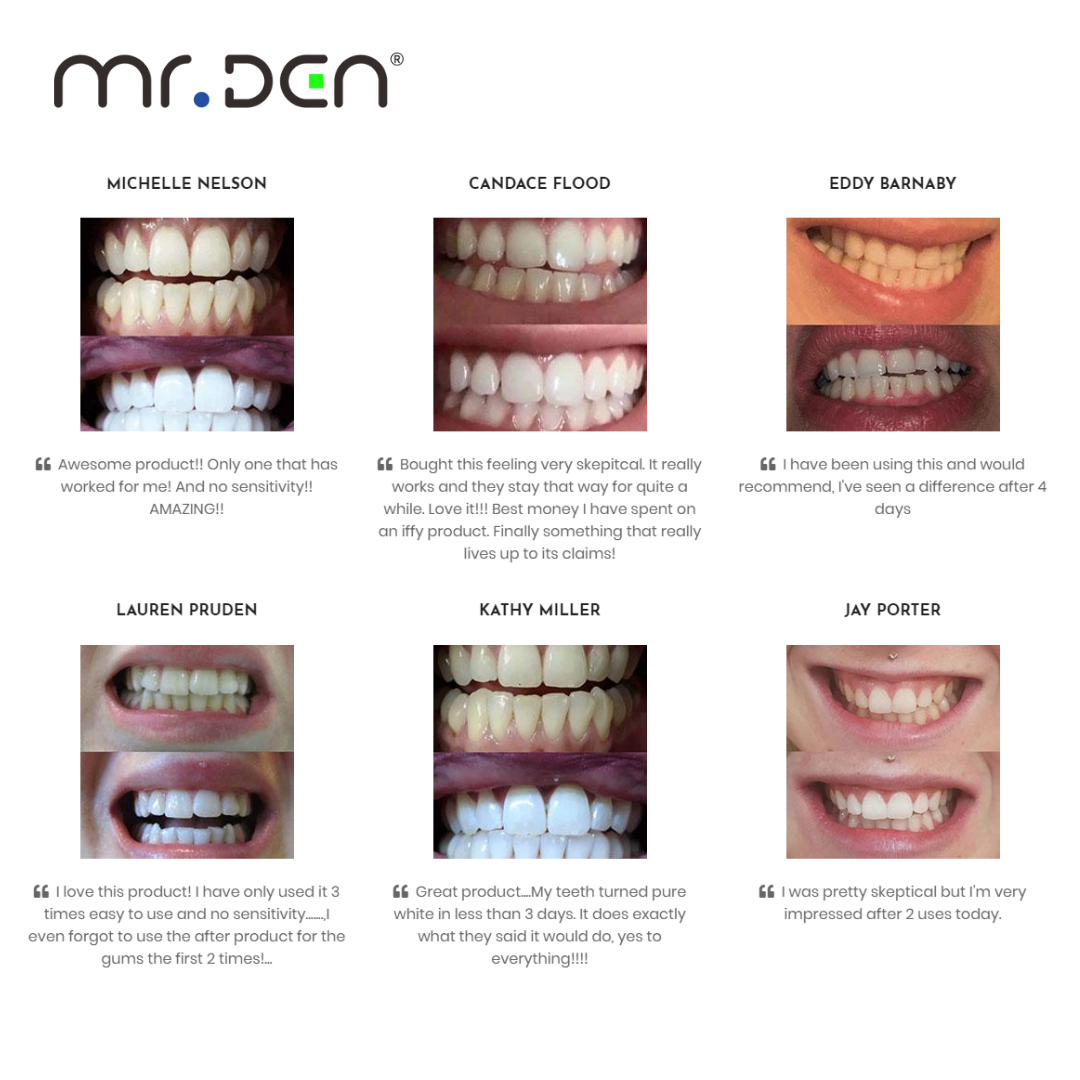 دكتور وايتن 3 عبوات من مجموعة  - مراجعة Teeth Whitening China وسعره