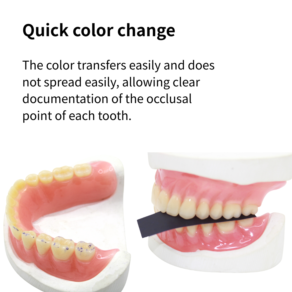 ورق تقويم الأسنان AG 300 ورقة/ - مراجعة Teeth Whitening Retainer وسعره