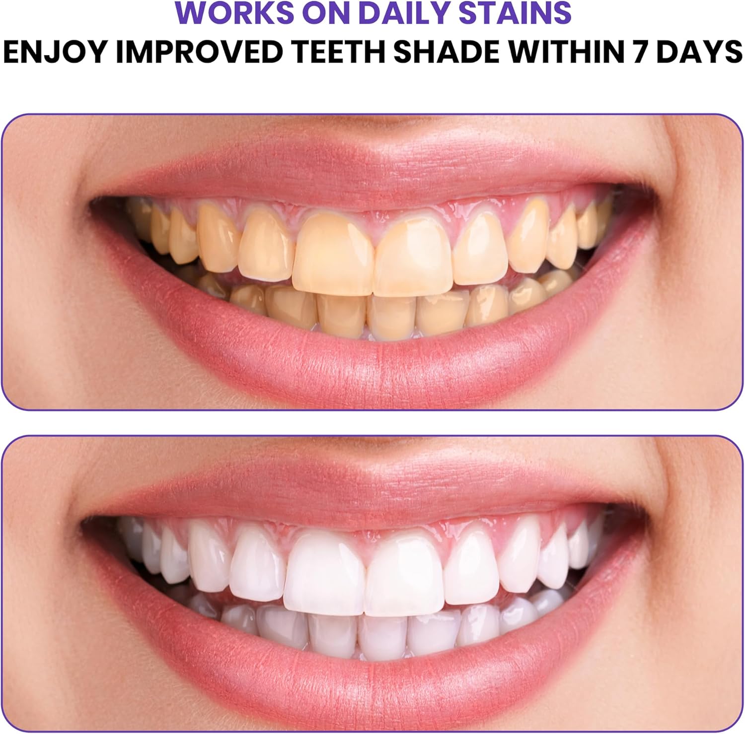 شرائط تبييض الأسنان المتقدمة ب - مراجعة Teeth Whitening Strips Crest وسعره