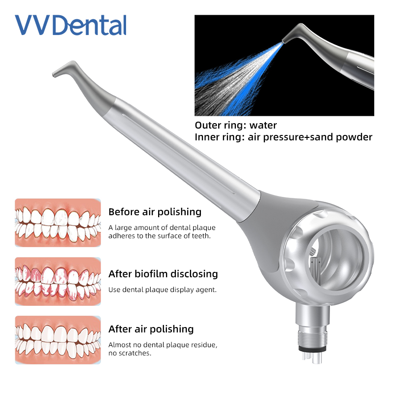 مسدس تبييض الأسنان VV Dental ب - مراجعة Teeth Whitening China وسعره