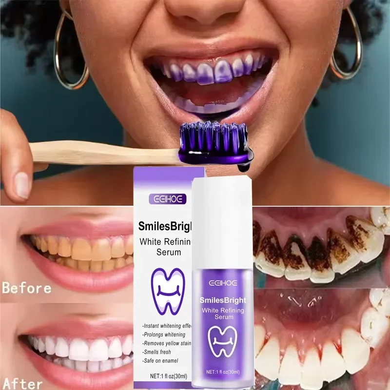معجون أسنان مبيض لتنظيف الأسنا - مراجعة Teeth Whitening Korea وسعره