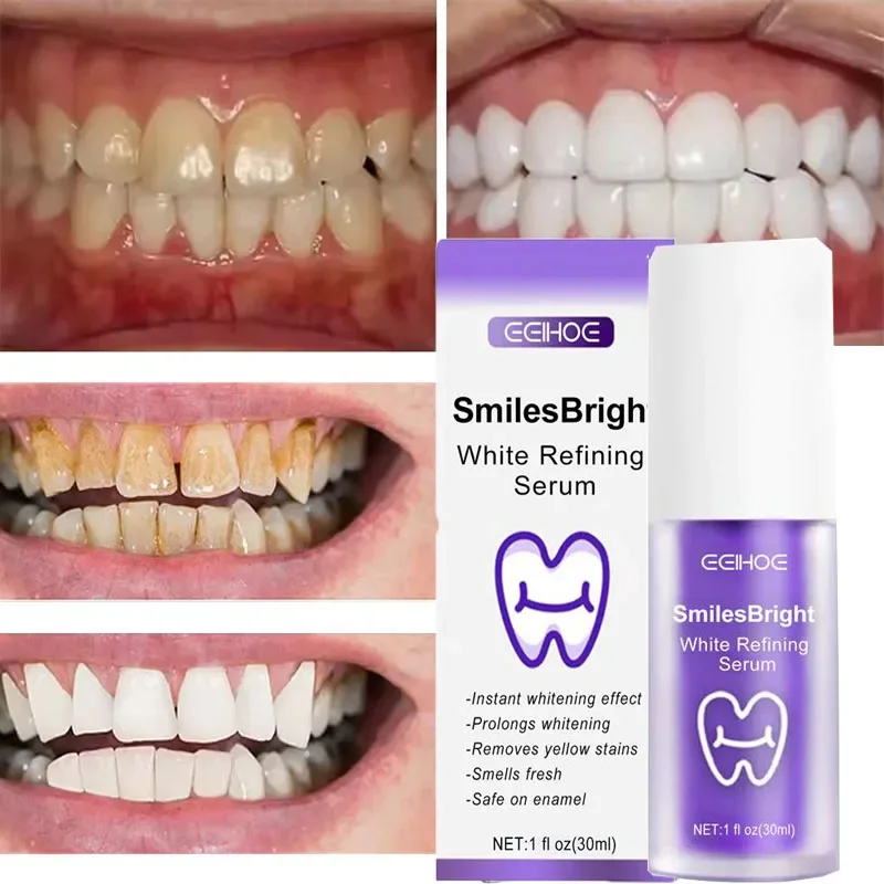 معجون أسنان مبيض لتنظيف الأسنا - مراجعة Teeth Whitening Korea وسعره