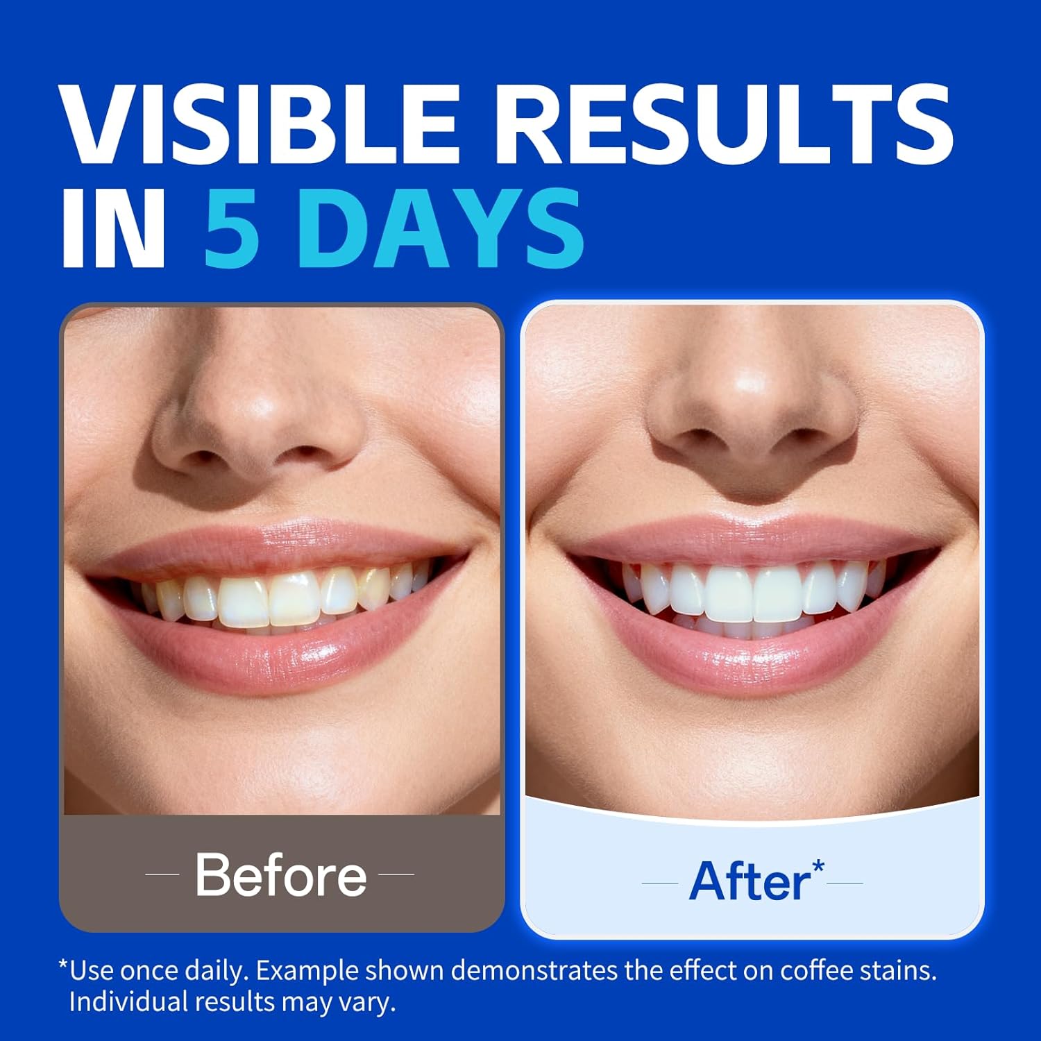 7 أزواج من شرائط تبييض الأسنان - مراجعة Teeth Whitening Strips Crest وسعره