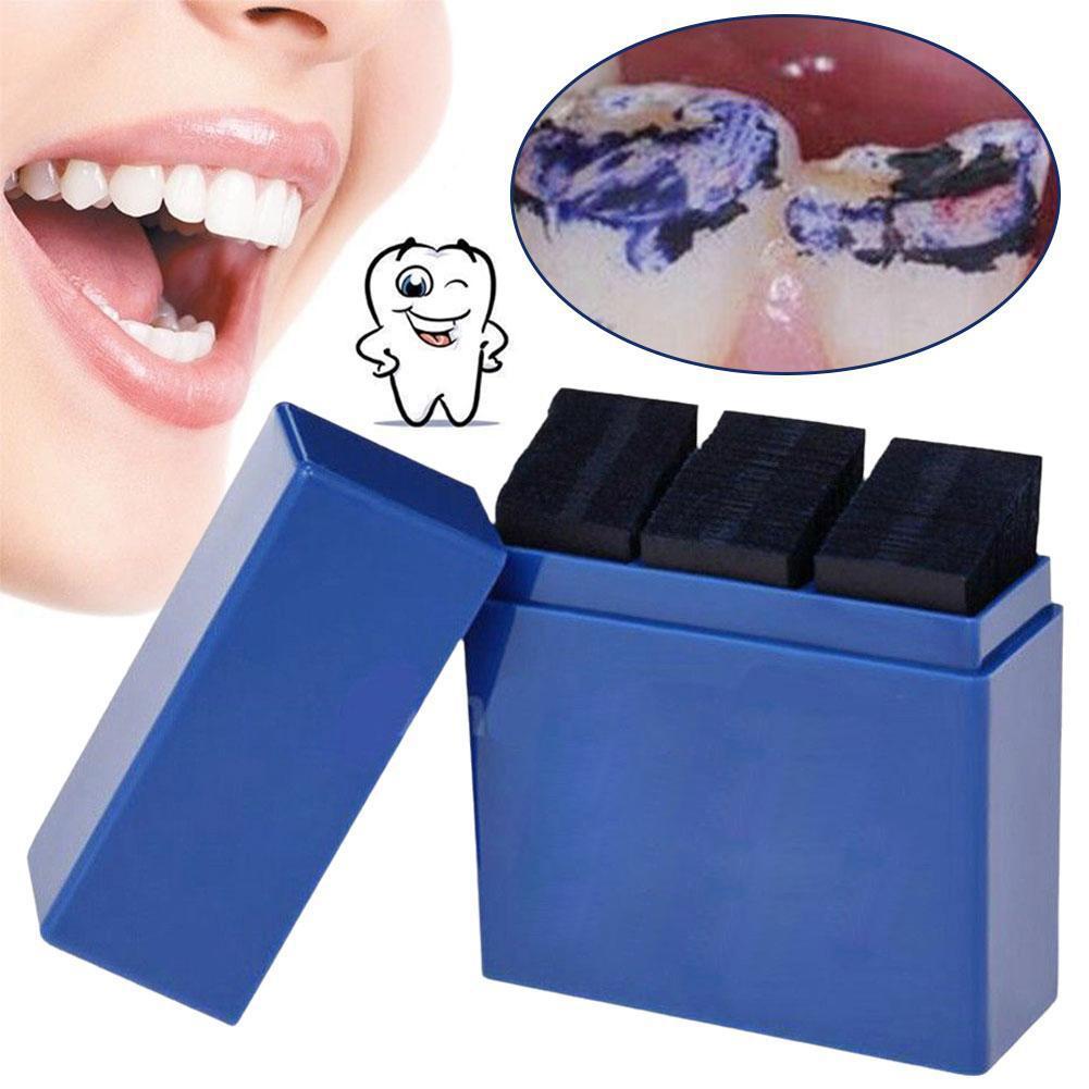 300 ورقة من ورق التقويم الأسنا - مراجعة Teeth Whitening Retainer وسعره