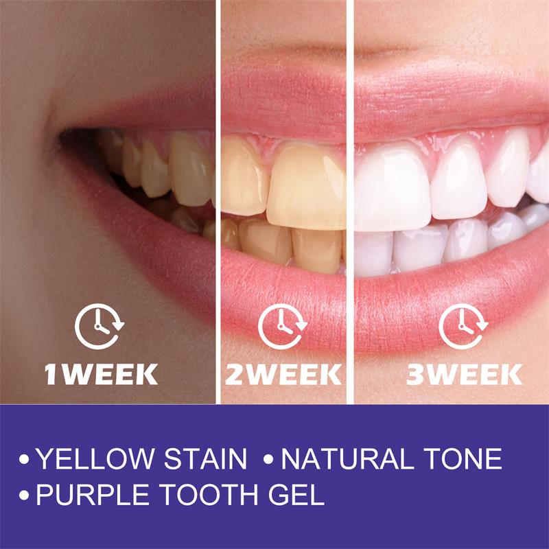 1 قطعة تنظيف الأسنان تبييض معج - مراجعة Teeth Whitening Korea وسعره
