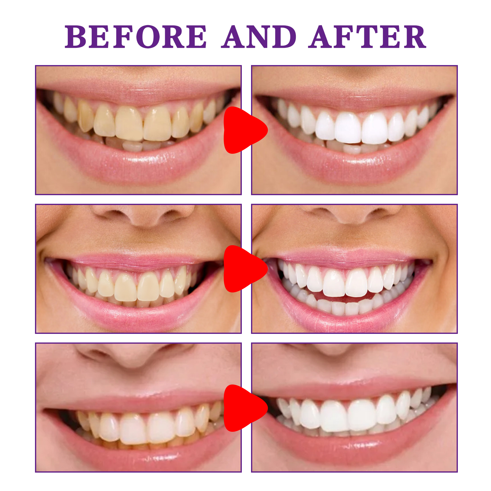 معجون أسنان لتبييض وتنظيف الأس - مراجعة Teeth Whitening Korea وسعره