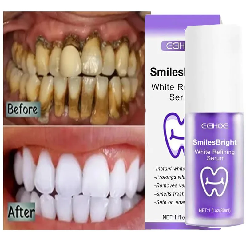 معجون أسنان مبيض لتنظيف الأسنا - مراجعة Teeth Whitening Korea وسعره