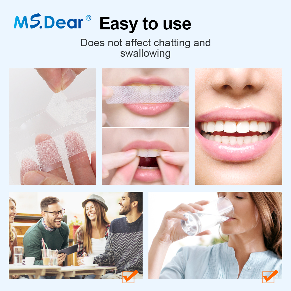 7/14/21/28/70 Pairs 9D جل تبيي - مراجعة Teeth Whitening Strips Crest وسعره