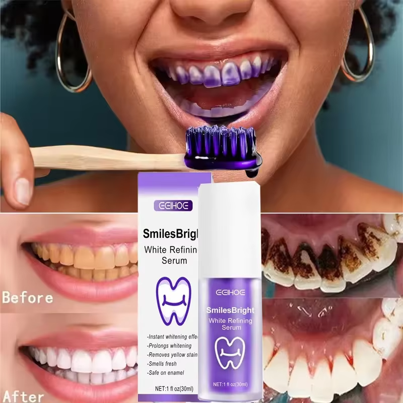 معجون أسنان مبيض لتنظيف الأسنا - مراجعة Teeth Whitening Korea وسعره